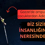 Gazze'de ampute edilen çocuklardan Adidas'a tepki: Biz sizin insanlığınızın neresindeyiz?