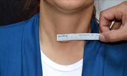 Tiroid Nedir? Nasıl Tedavi Edilir?