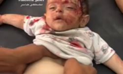 Katil İsrail'in ağır yaraladığı bebek için zamanla yarış