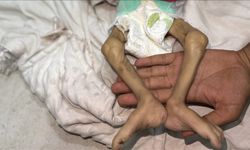Gazze'de 5 kişi daha açlıktan öldü