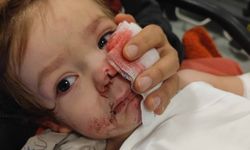 Pitbull saldırısı sonrası ilk kavuşma: Kardeşler yeniden bir arada