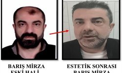 Ameliyat ile yüzünü değiştiren firari cinayet zanlısı 7 yıl sonra yakalandı