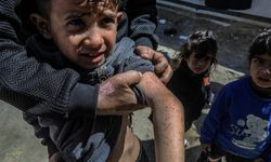 Gazze'de 'salgın hastalık' alarmı!