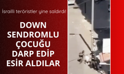 İsrailli teröristler down sendromlu çocuğu darp etti