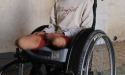 Gazze'de 6 bin 600'den fazla kişiye protez veya rehabilitasyon gerek