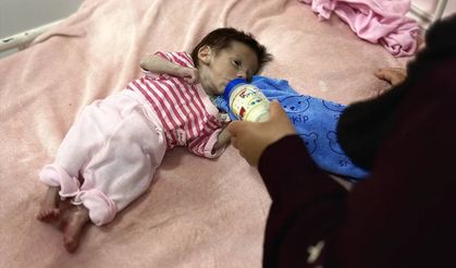 Gazze'de bir bebek daha açlıktan ölmek üzere