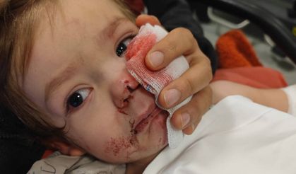 Pitbull saldırısı sonrası ilk kavuşma: Kardeşler yeniden bir arada