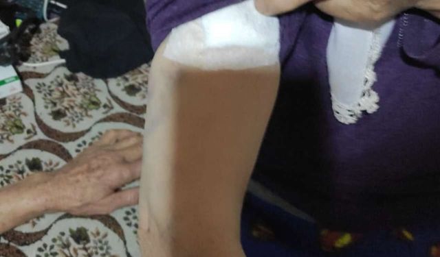 Burdur'da köpeklerin saldırdığı kadın yaralandı