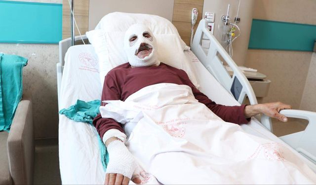 Gaz kaçağını çakmakla kontrol eden adam ağır yaralandı