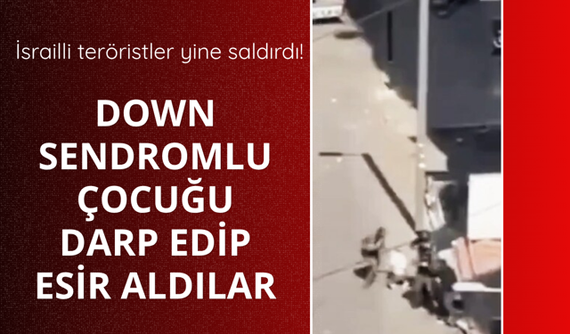 İsrailli teröristler down sendromlu çocuğu darp etti