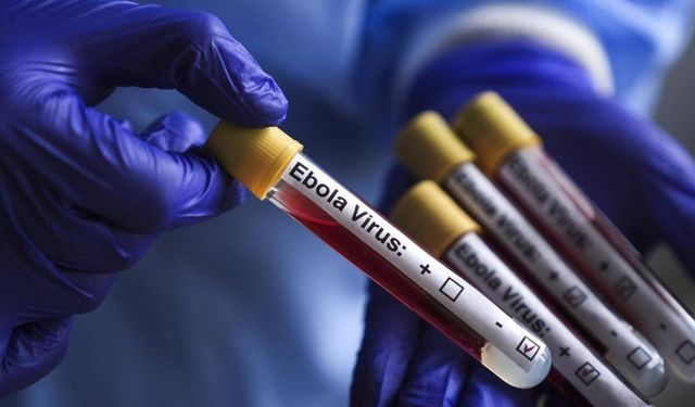 DSÖ: KDC'deki Ebola salgınında 267 kişi öldü