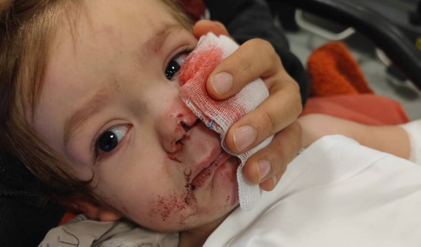 Pitbull saldırısı sonrası ilk kavuşma: Kardeşler yeniden bir arada