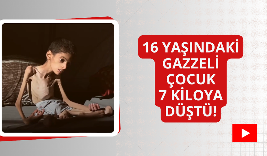 16 yaşındaki Gazzeli çocuk 7 kiloya düştü!