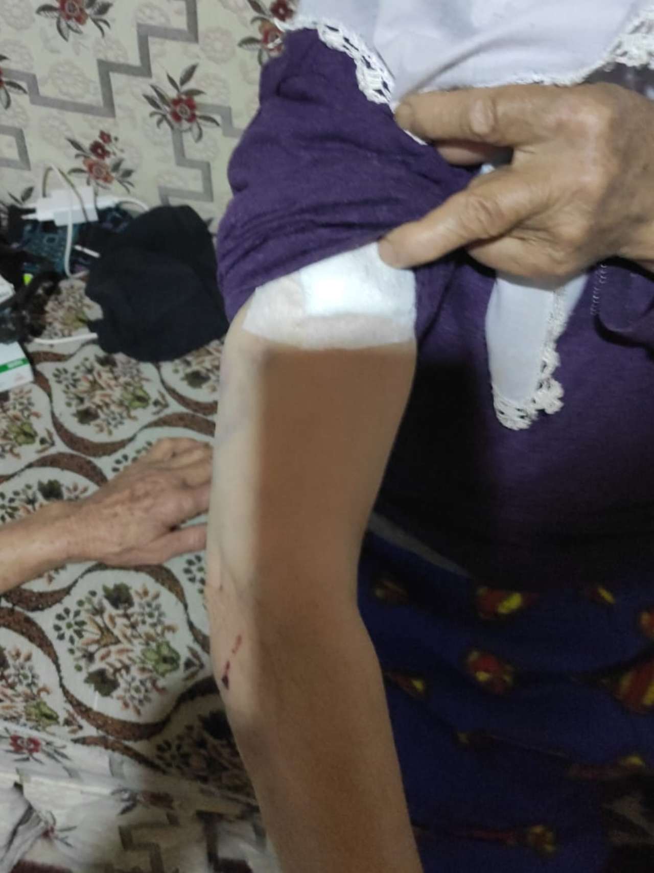 Burdur'da köpeklerin saldırdığı kadın yaralandı